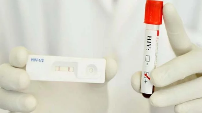 Varian HIV Baru Terdeteksi di Belanda, Disebut Sangat Mematikan - Tribun-bali.com
