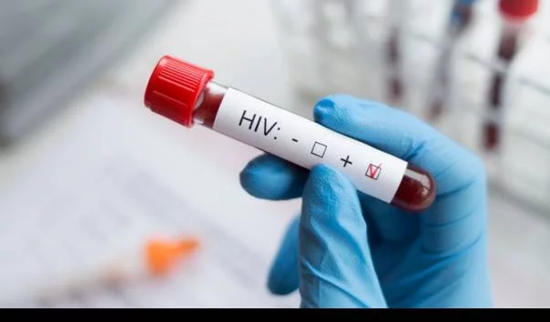 Lansia di AS Jadi Perempuan Pertama yang Sembuh Total dari HIV Usai Transplantasi Sel Induk