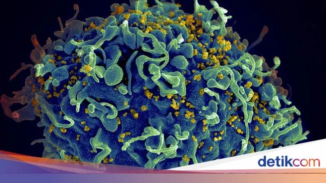 Pasien Ketiga HIV Berhasil Sembuh Berkat Terapi Sel Punca