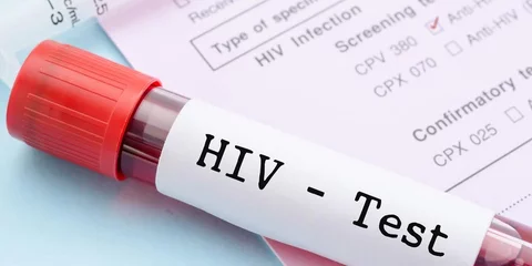 Sejarah Baru, Perempuan Pertama di Dunia Sembuh dari HIV