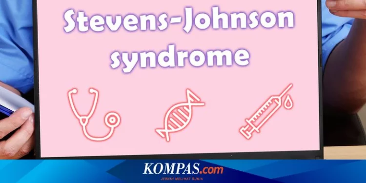 Penyebab Sindrom Stevens Johnson, Penyakit Langka Pada Kulit