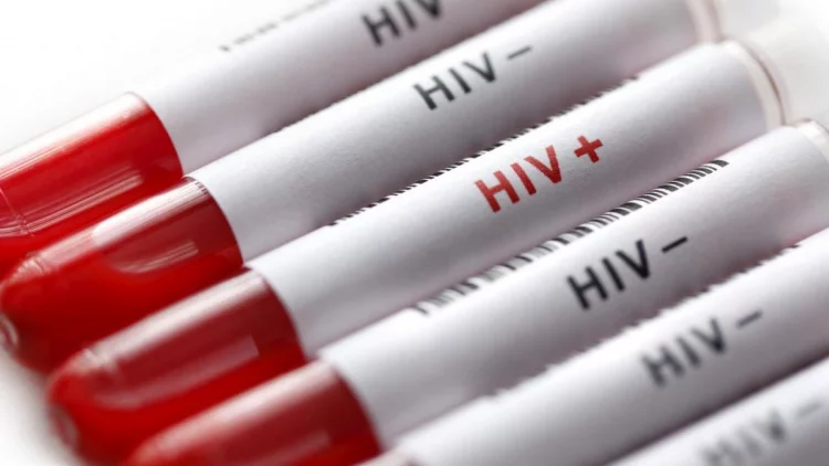 Jumlah Penderita HIV/AIDS di Magetan Terus Bertambah dari Tahun ke Tahun