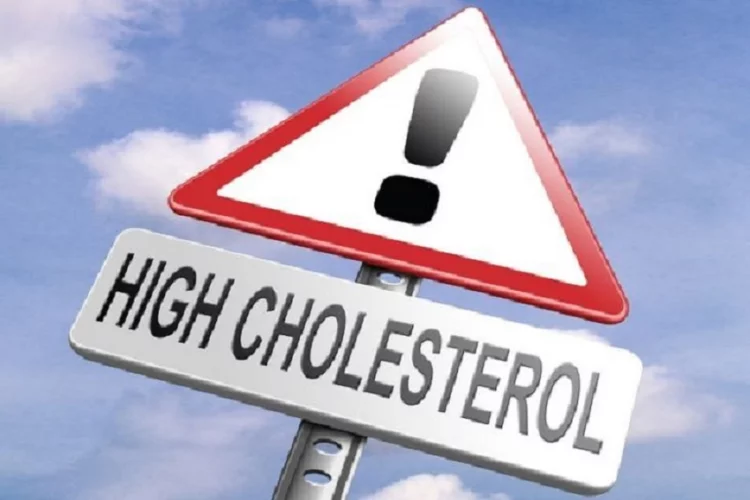 Kolesterol Tinggi, 3 Gejala di Tangan yang Harus Diperhatikan