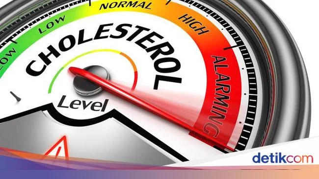 Waspadai Tanda-tanda Kolesterol Tinggi, Bisa Picu Stroke dan Jantung