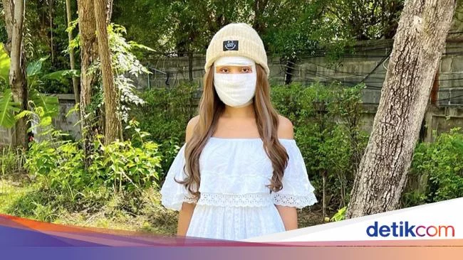 8 Foto Terbaru Lucinta Luna Usai Operasi Ganti Kepala, Mirip Lisa BLACKPINK?