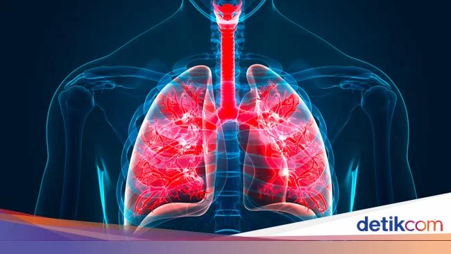Ditemukan Organ Tubuh Baru, Tersembunyi di Paru-paru Kita