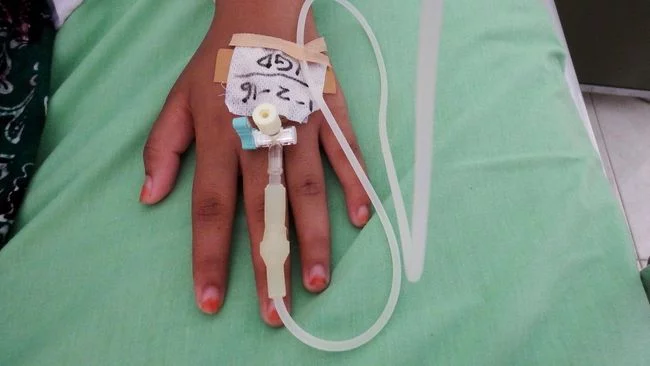 Waspada Dengue Shock Syndrome, Komplikasi DBD yang Berakibat Fatal