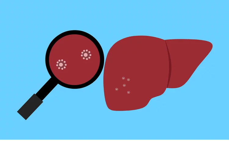 Pejabat Kesehatan di Eropa dan AS Selidiki Hepatitis Akut pada Anak-anak, 74 Kasus Ditemukan di Inggris