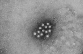 WHO: Lonjakan Kasus Hepatitis Akut Sebabkan Seorang Anak Meninggal