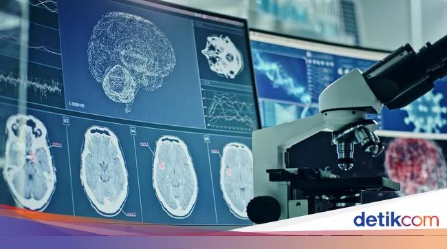 Misteri Ratusan Alumni SMA Top di AS Idap Tumor Ganas Glioblastoma