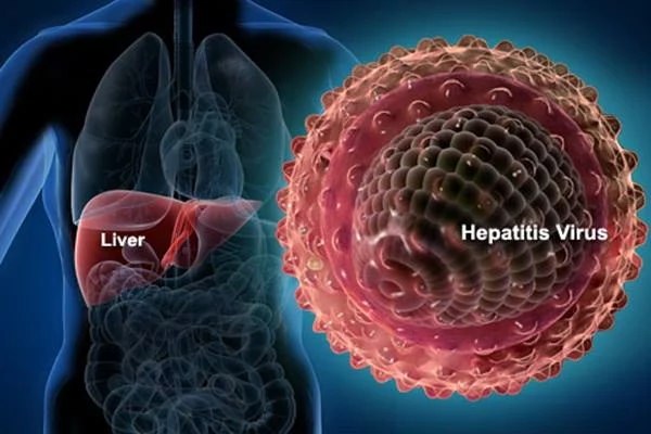 Hepatitis Akut Misterius pada Anak, Pahami Kemungkinan Penyebab dan Pencegahannya