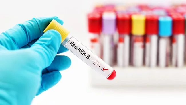 Total 7 Anak di RI Meninggal Diduga Hepatitis Misterius
