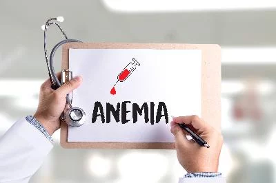 Kondisi Hemoglobin Rendah Menyebabkan Tubuh Lemas, Apa Itu Anemia?
