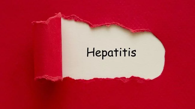RSCM Pastikan Kasus Hepatitis Akut di DKI Tak Saling Terkait