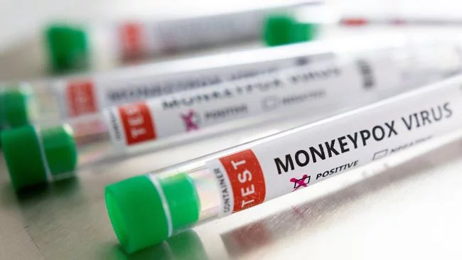 Bertambah, Jumlah Pasien Cacar Monyet di Inggris Jadi 70 Kasus