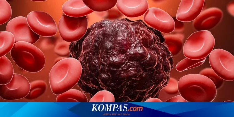 7 Gejala Kanker Darah Stadium Awal yang Perlu Diwaspadai