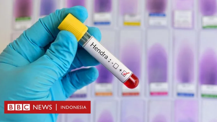 Virus Hendra lebih mematikan daripada Covid-19, apa gejalanya dan bisakah menjalar ke Indonesia?