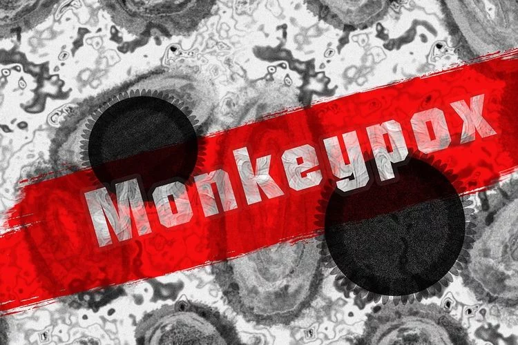 Aturan Baru di Inggris, Pasien yang Terinfeksi Cacar Monyet Dilarang Hubungan Seks - Pikiran-Rakyat.com