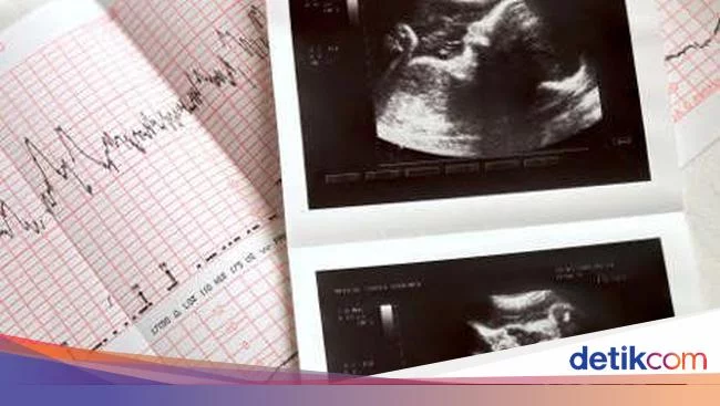 Wanita Pemilik 7 Janin Membusuk di Makassar Lakukan Aborsi Sejak 2012