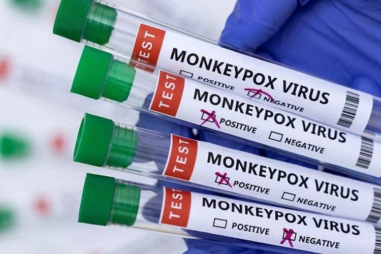 Sempat Heboh Karena Diduga Sebagai Efek Samping dari Vaksin Booster, Berikut Penjelasan Mengenai Cacar Monyet