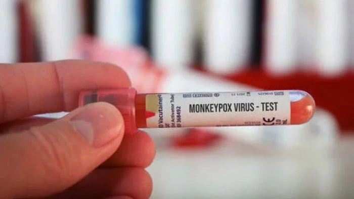 Tidak Hanya untuk Covid-19, PCR Test Punya Peran Penting Deteksi Monkeypox