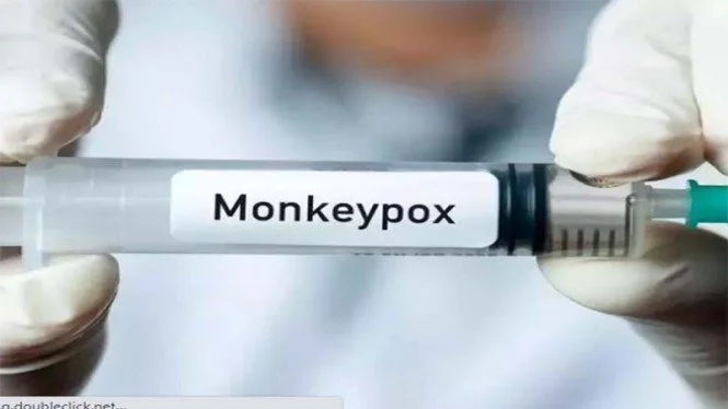 CDC: Nyeri Radang di Bokong Tanda Cacar Monyet Mengintai