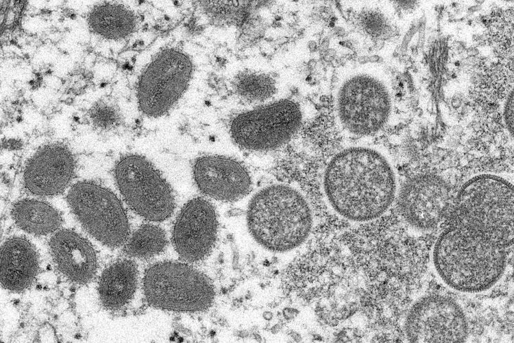 WHO Tengah Selidiki Laporan Penemuan Virus Cacar Monyet di Sperma Pasien