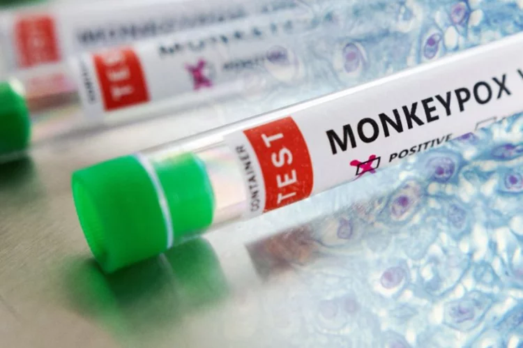 WHO Hapus Perbedaan Negara Endemik dan Non Endemik Monkeypox