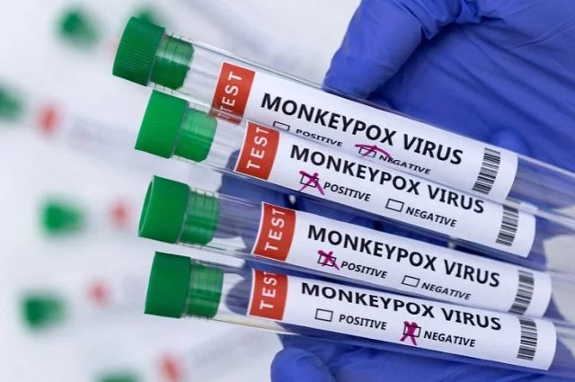 Virus Cacar Monyet Sudah Sampai Singapura, Pertama di Asia Tenggara