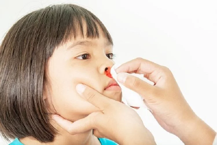 lapisan Pembuluh Darah Dihidung Pecah? Inilah 10 Penyebab Sering Mimisan!