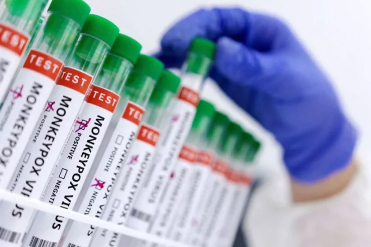 AS Kekurangan Vaksin Saat Kasus Cacar Monyet Meningkat
