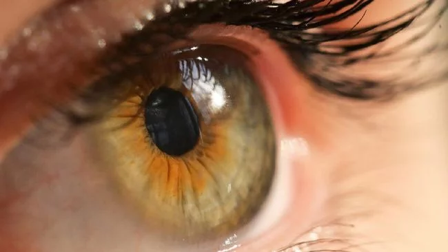 3 Ciri-ciri Kolesterol Tinggi pada Mata, Waspada Gangguan Penglihatan