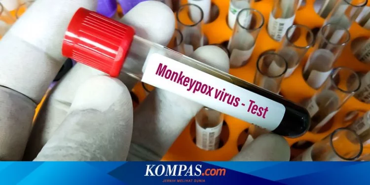 Deteksi Dini Cacar Monyet, Reagen Disebar ke Lab Seluruh Indonesia Halaman all