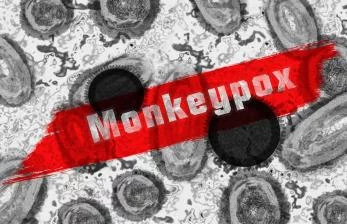 AS Tambah Stok Vaksin Monkeypox Sebanyak 786 Ribu Dosis