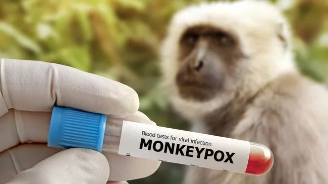 4 Kematian Akibat Cacar Monyet di Luar Afrika, Terjadi dalam Seminggu
