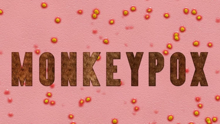 Waspada Monkeypox, IDI Siapkan Satgas Khusus Cacar Monyet