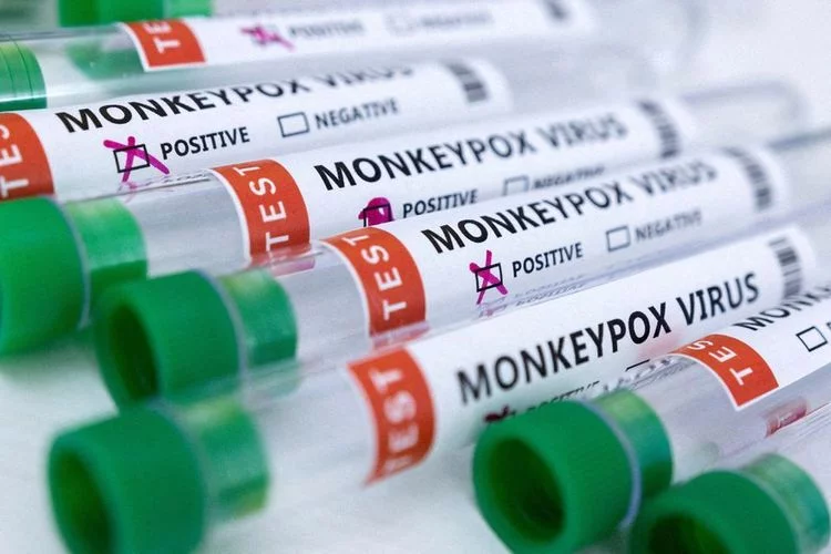 8 Pertanyaan Soal Cacar Monyet, Siapa Paling Rentan Terinfeksi hingga Bahayanya bagi Ibu Hamil dan Menyusui