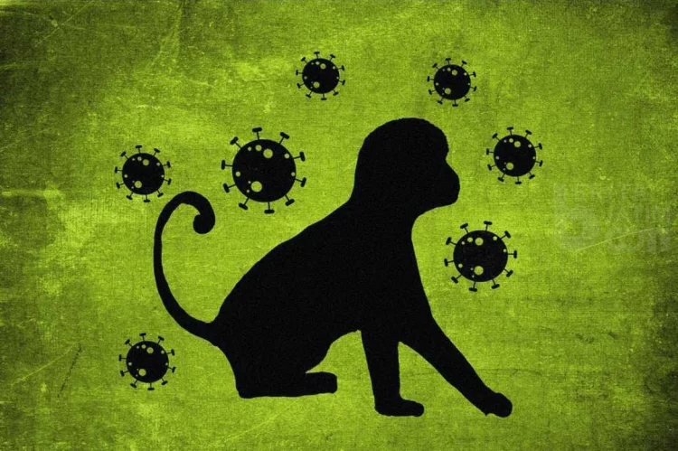 Mengenal Cacar Monyet dan Gejalanya, Ketahui Proses Penularan Sebelum Terjangkit