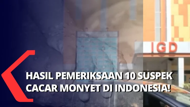 Waspada Cacar Monyet! Indonesia Temukan 10 Pasien Suspek "Monkeypox", 9 Negatif