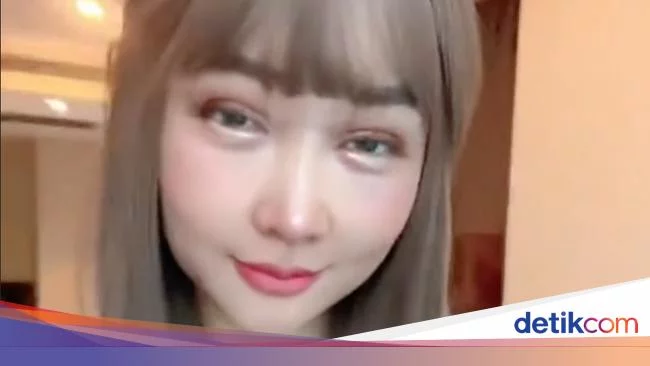 7 Foto Wajah Baru Lucinta Luna yang Tak Lagi Ditutupi, Jadi Bak Cewek Korea?