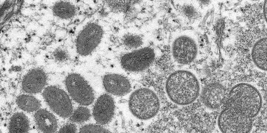 Penelitian: Virus Cacar Monyet Bisa Bertahan Lama di Berbagai Peralatan Rumah