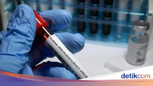 664 IRT di Bandung Tertular HIV AIDS gegara Suami 'Jajan Sembarangan'