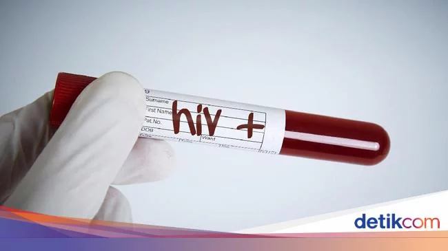 Gejala Awal HIV Mirip Flu, Ini Bedanya dengan COVID-19