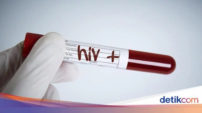 Bali Masuk 10 Besar Provinsi dengan Kasus HIV Terbanyak di RI