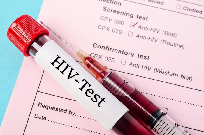 Lakukan 3 Cara Ini sebagai Pencegahan Kondisi HIV, Apa Saja?