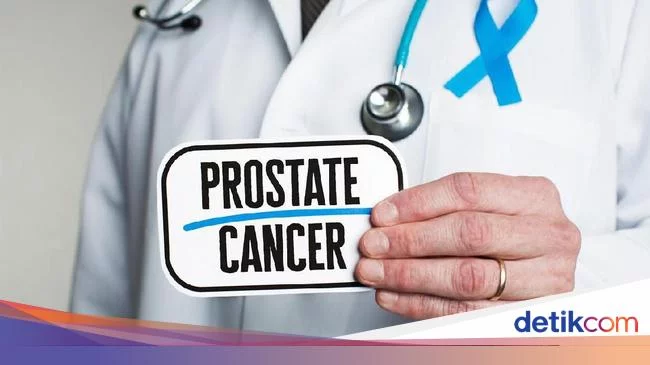Ejakulasi Tak Mencegah Kanker Prostat, Malah Bikin Radang kalau Berlebihan