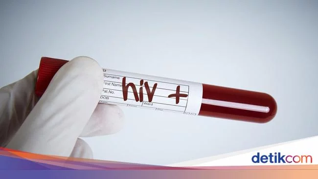 HIV Juga Jangkiti Remaja, Dipicu Narkoba hingga Seks Sesama Jenis