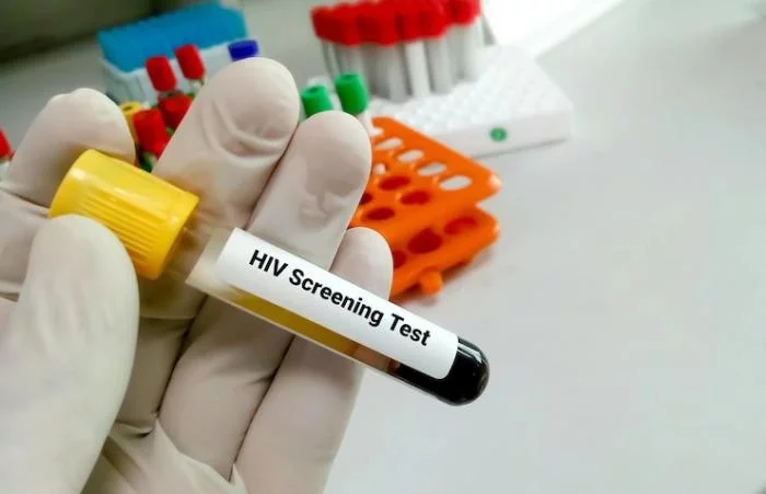 Miris! Data Terbaru Sebut 1.188 Anak di Indonesia Positif HIV, Termasuk Ratusan Balita