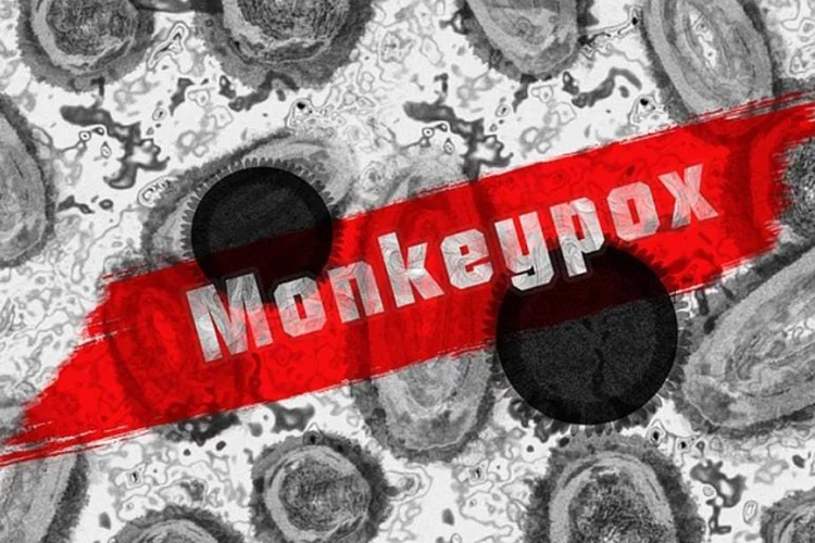 Penjelasan Cacar Monyet, Lengkap dengan Gejala, Penularan dan Cara Pencegahan Monkeypox