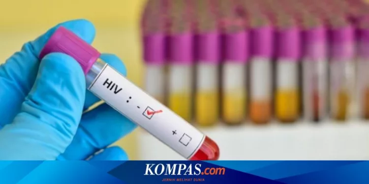 Ibu Rumah Tangga Jateng Terinfeksi HIV/AIDS, Sebagian Besar Tertular Suami